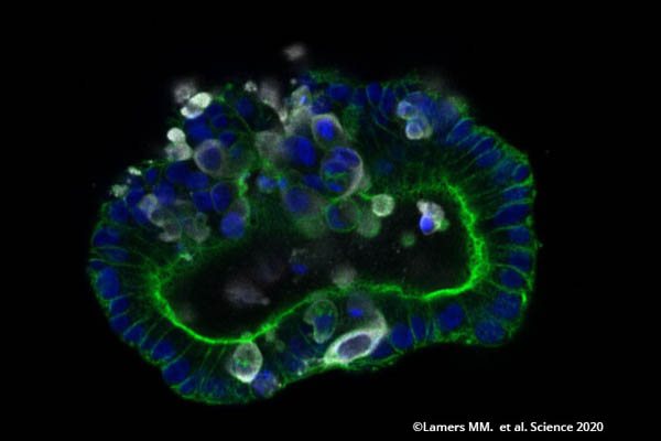 Gut organoid